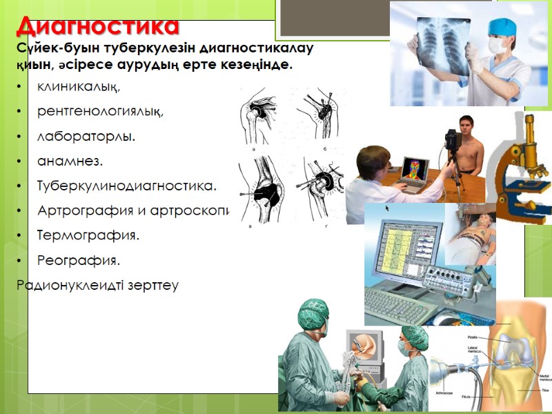 Диагностика  Сүйек-буын туберкулезін диагностикалау  қиын, әсіресе аурудың ерте кезеңінде. клиникалық, рентгенологиялық, лабораторлы.